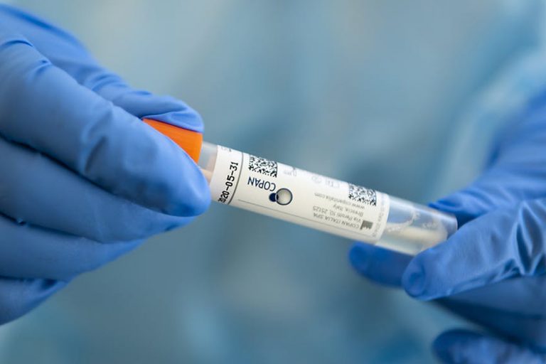 coronavirus positiva dopo 55 giorni