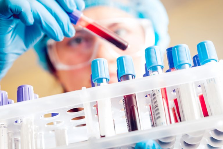 Coronavirus, dal 6 aprile a Prato si potrà fare il tampone privato
