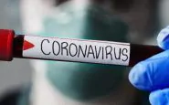 coronavirus rezza
