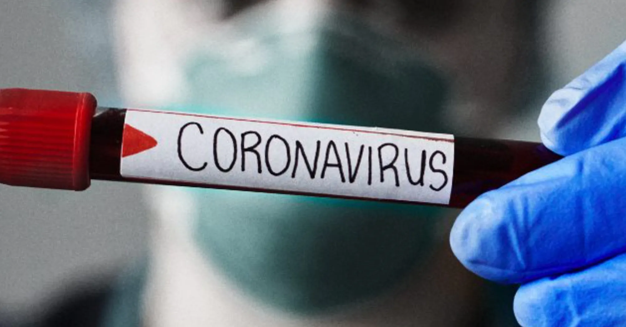 coronavirus rezza