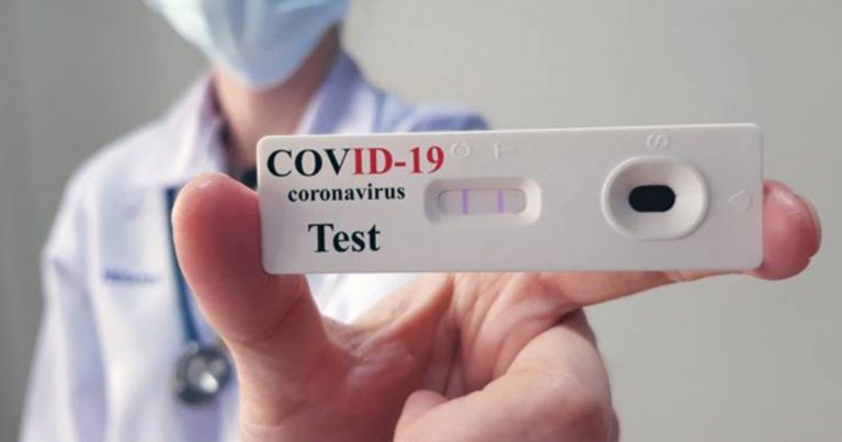 coronavirus-test-seriologici