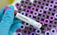 coronavirus test sierologici