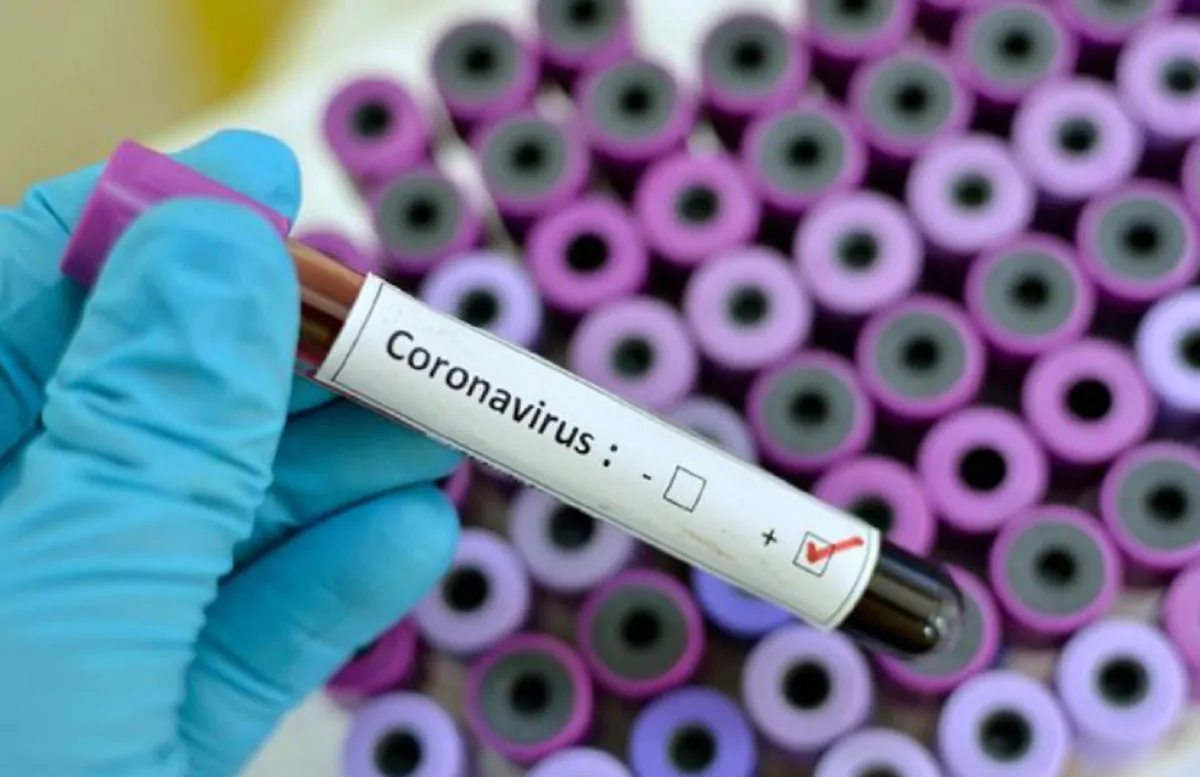 coronavirus test sierologici