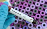 tipi-coronavirus-diffusione