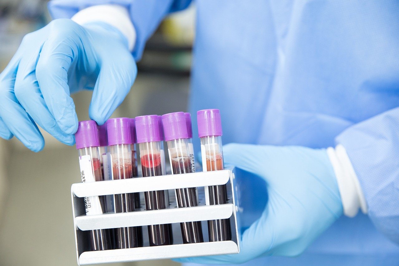 coronavirus campioni di sangue