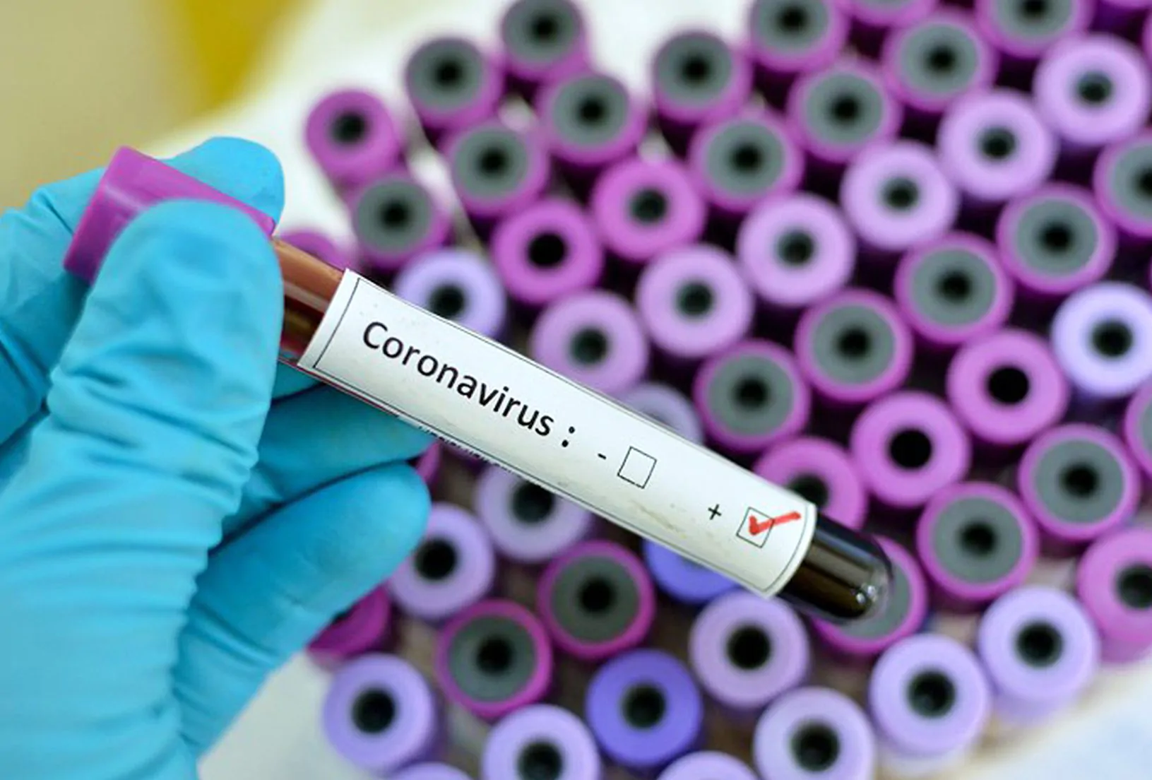 coronavirus-scudo-genetico