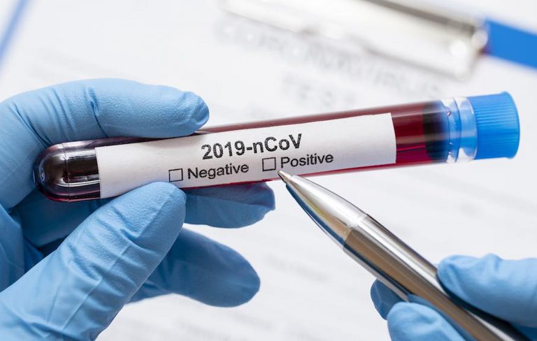 coronavirus-trapani