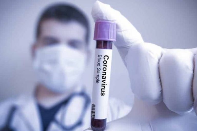 coronavirus-trapani