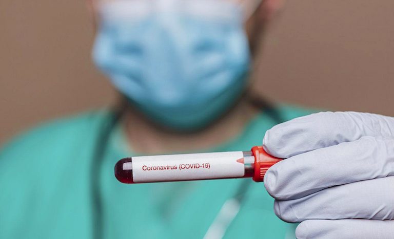 coronavirus-vitamina-d