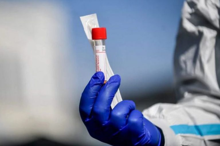 Rilevate tracce di coronavirus nel liquido seminale di alcuni pazienti
