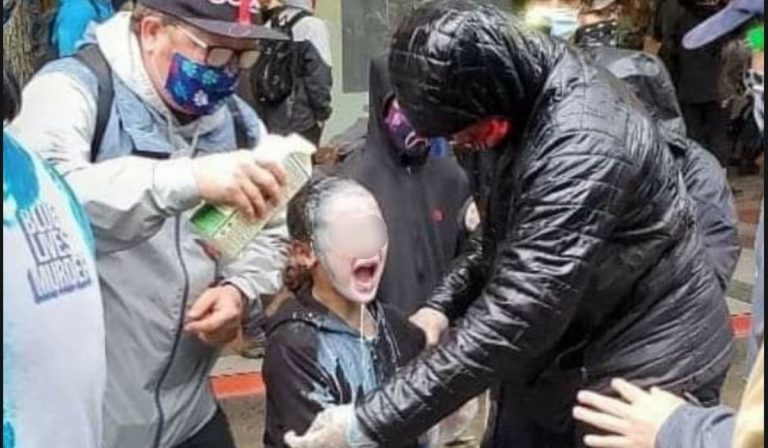 Bambina colpita da uno spray al peperoncino a Seattle
