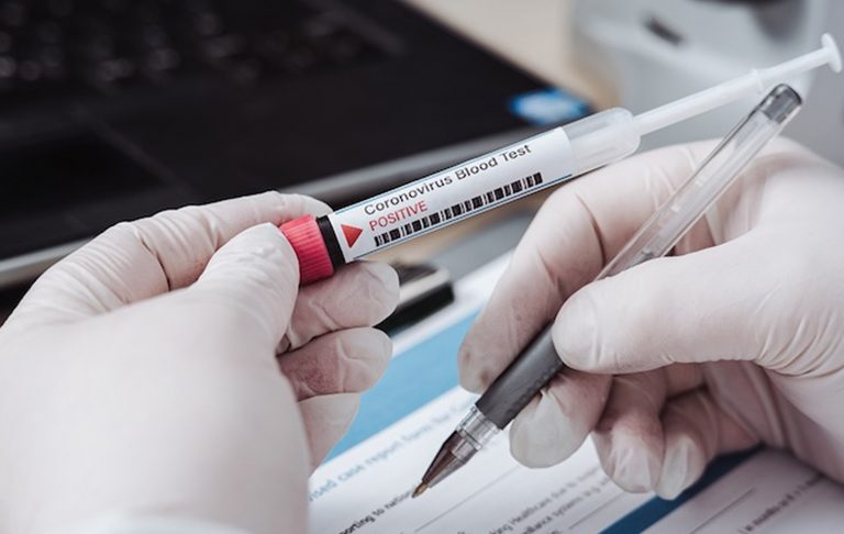 coronavirus-ospedale