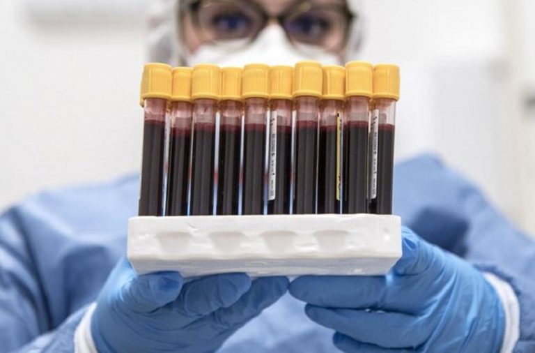 Una ricerca italiana spiega perché alcune persone sono più resistenti al Coronavirus