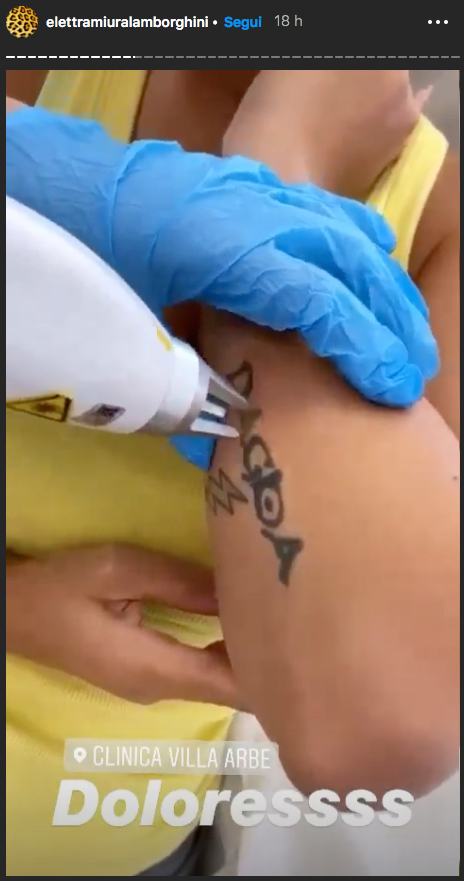 elettra lamborghini rimozione tatuaggi