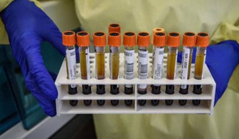 Ad Alzano Lombardo nessuno ha il coronavirus