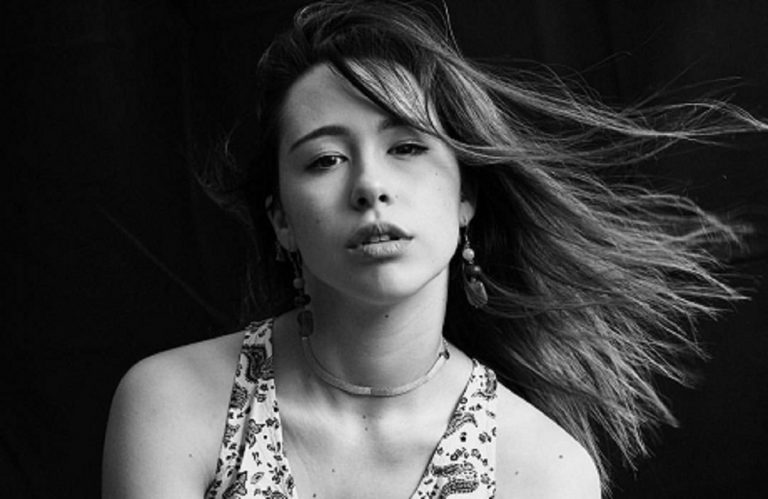 Aurora Ramazzotti: la foto con i brufoli sui social ha scatenato tanti like