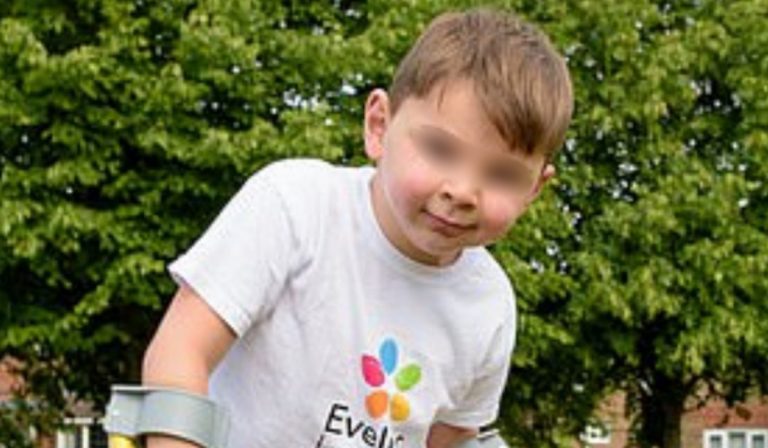 Tony, il bambino che cammina con le protesi per pagarsi un intervento