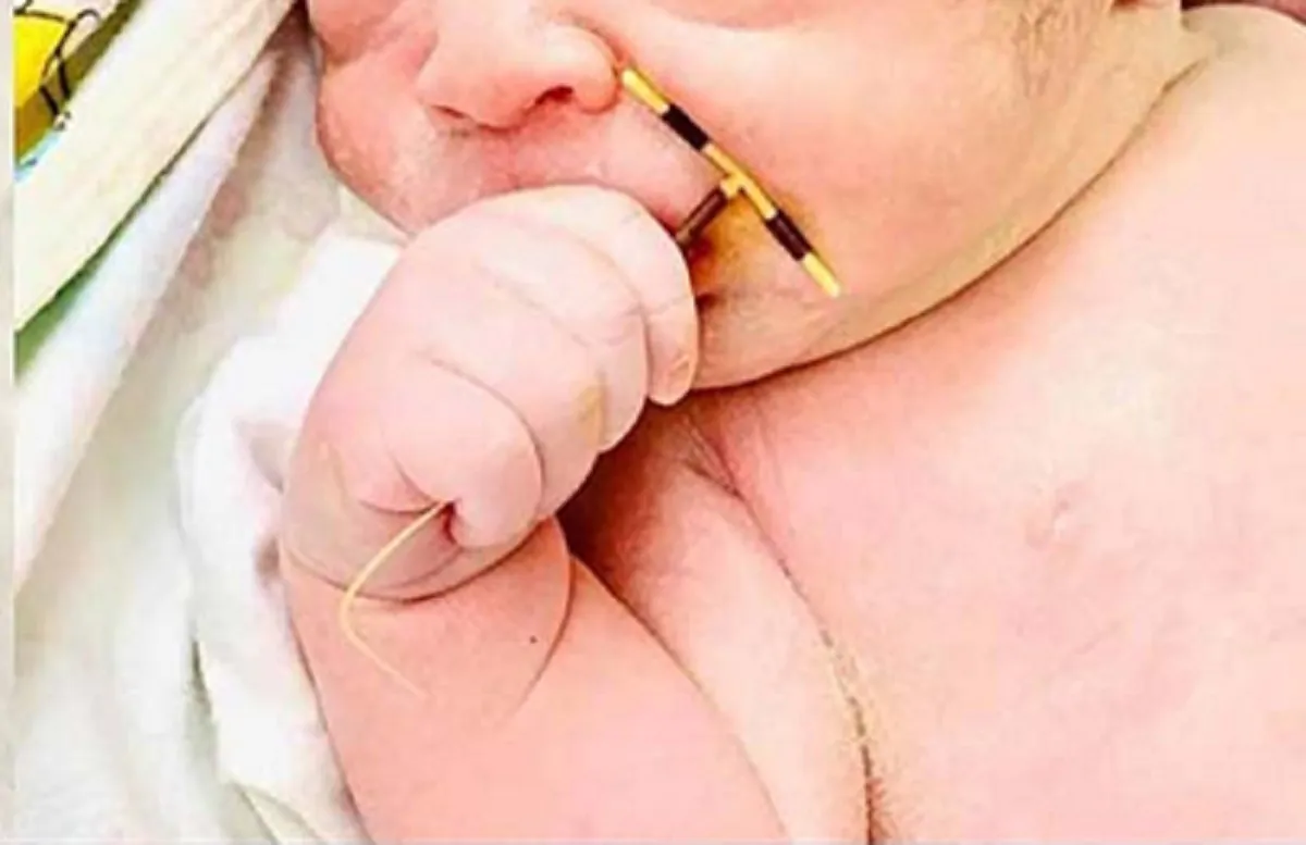 In Vietnam un bambino è nato tenendo nella manina la spirale intrauterina della mamma