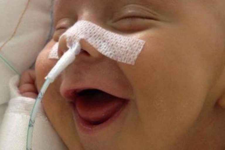 bambino prematuro coronavirus perù