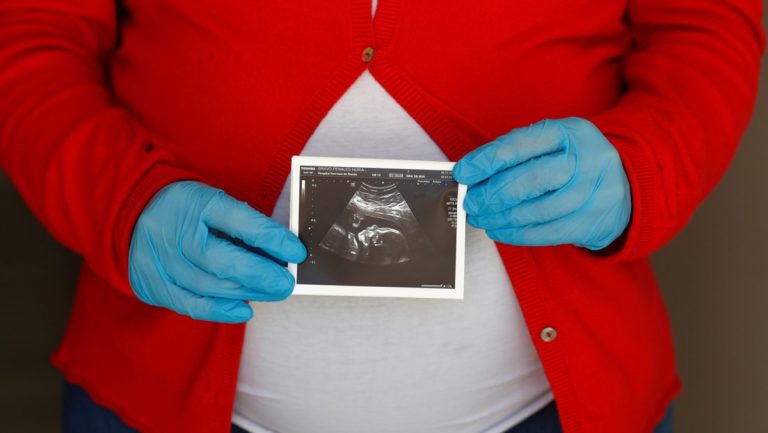 coronavirus contagio attraverso placenta