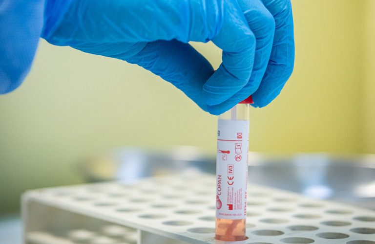 coronavirus età contagiati