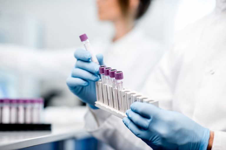 coronavirus raggi ultravioletti pianezza