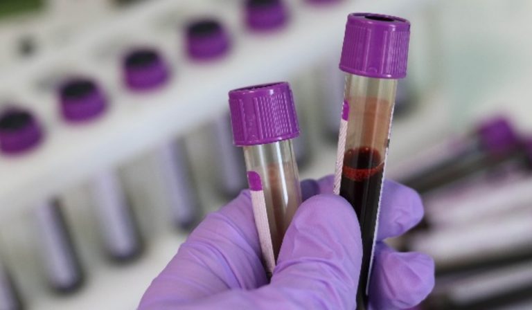 Coronavirus: forse il segreto della cura è in una proteina
