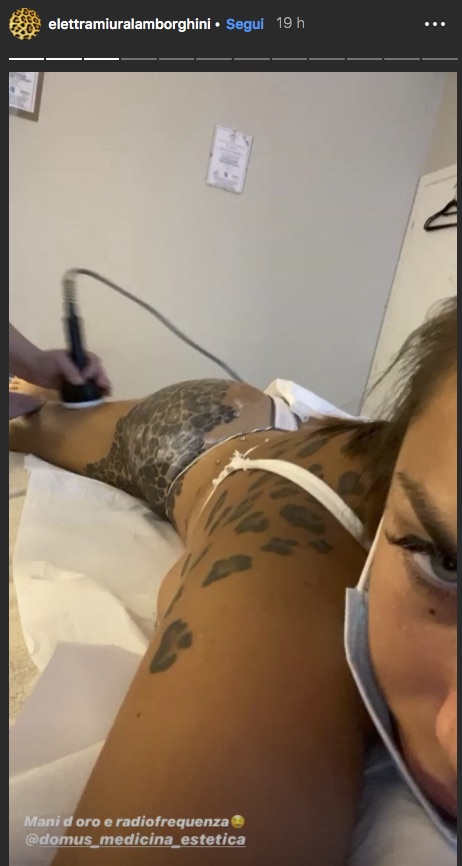 ElettraLamborghiniradiofrequenza