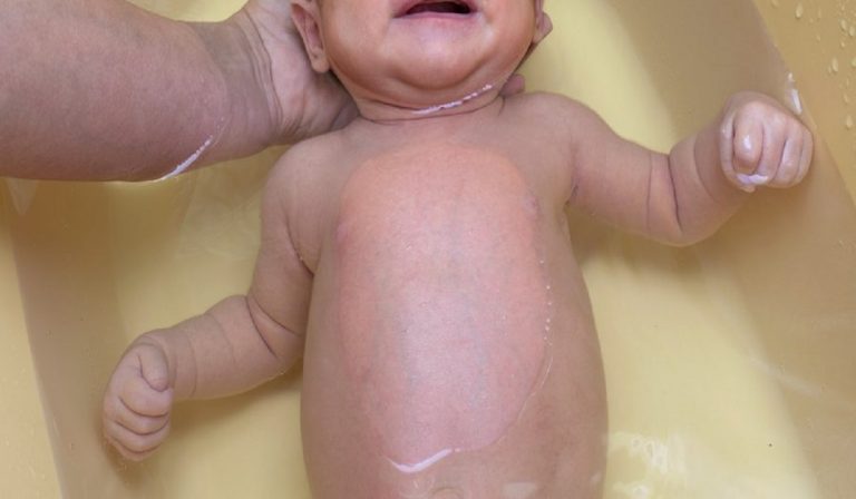 Neonato beve l'acqua del bagnetto, è grave
