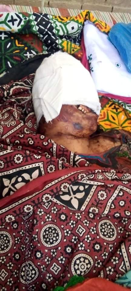 Il corpo torturato di Waazirah