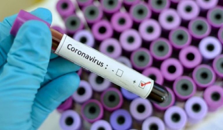coronavirus positiva da 5 mesi