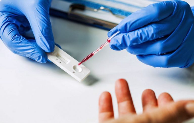 coronavirus, test sierologici e falsi positivi