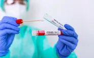Mortalità da Coronavirus: a rischio le persone Down