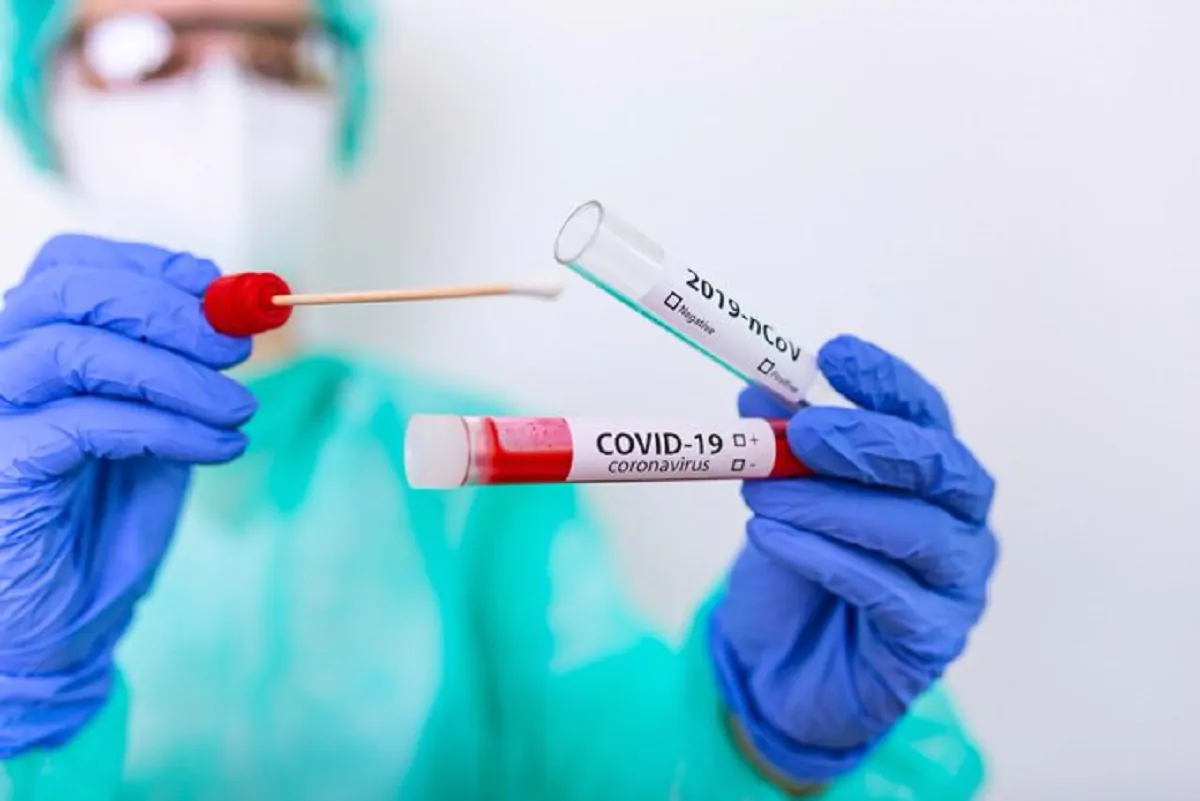 Mortalità da Coronavirus: a rischio le persone Down
