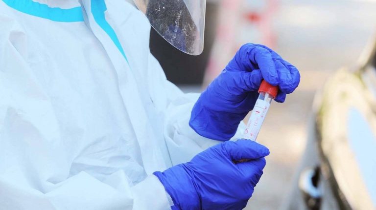 Tamponi e test sierologici Covid
