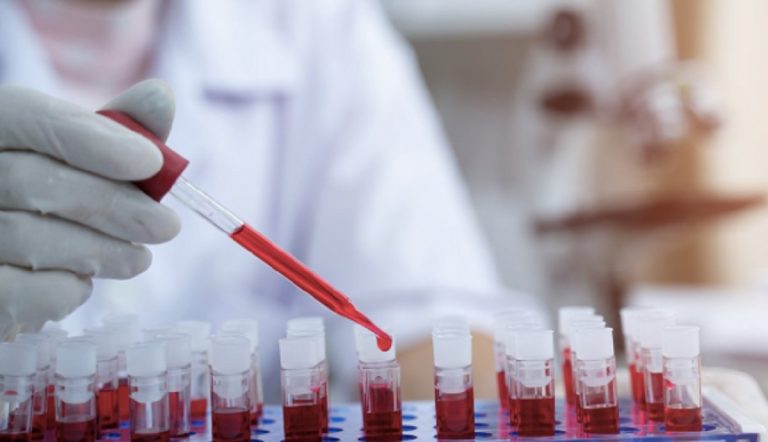 Australia hotel quarantena test hiv