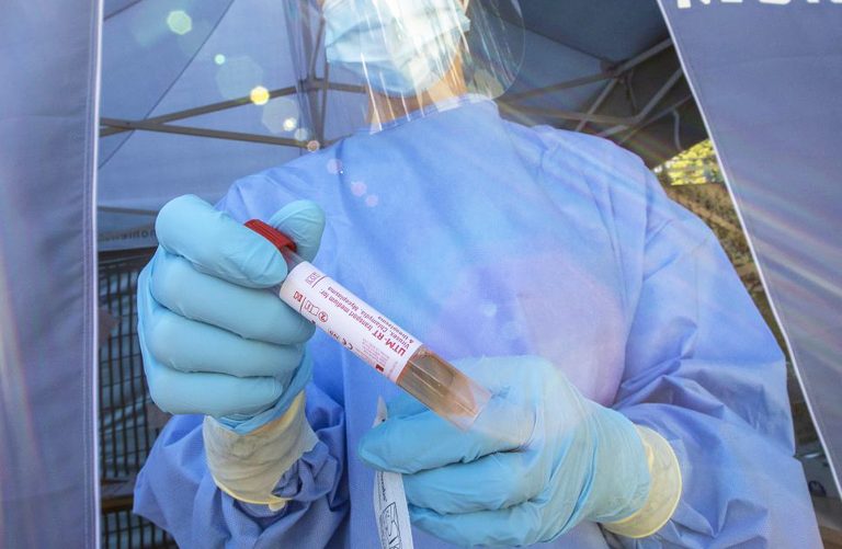 coronavirus-peggioramento