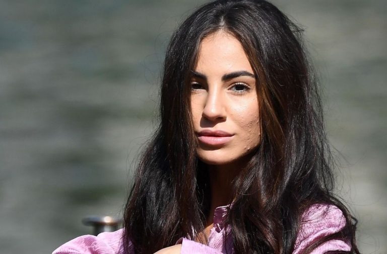 Giulia De Lellis acne
