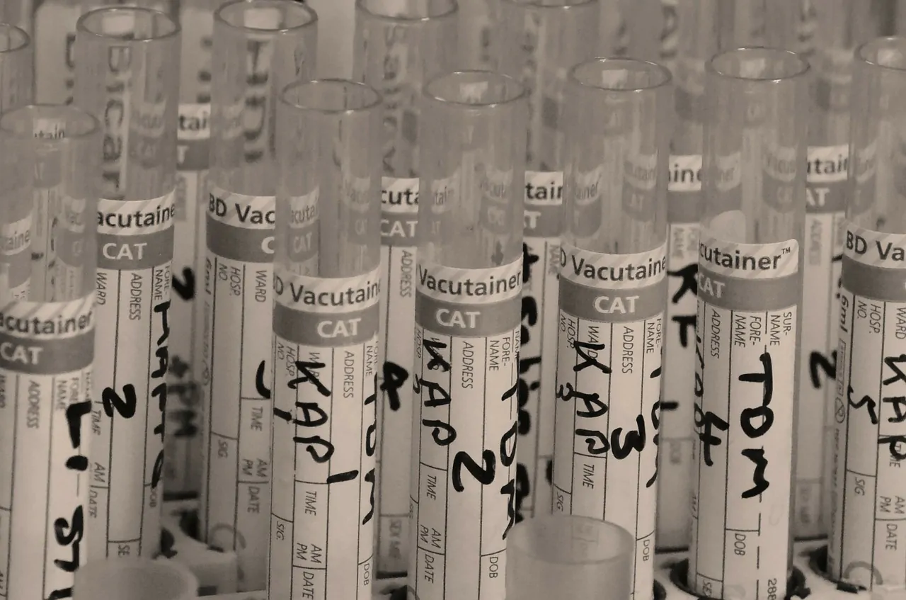 Il materiale presente nel laboratorio della ricerca per il farmaco contro il covid