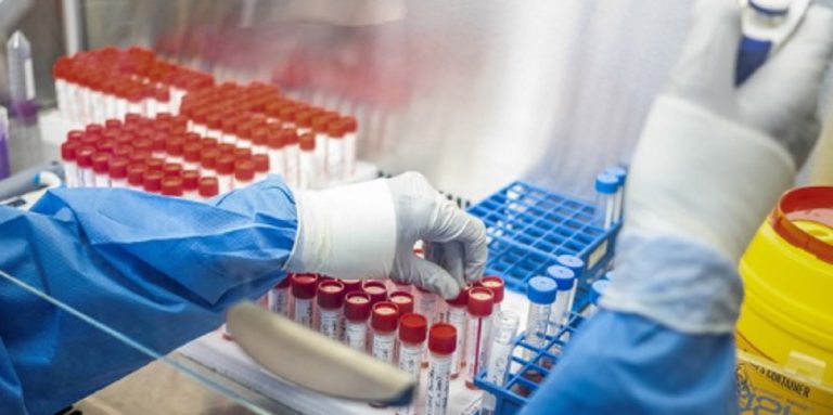 seconda ondata coronavirus