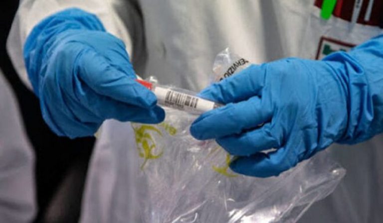 Lazio, il "trucco" tamponi per la zona gialla