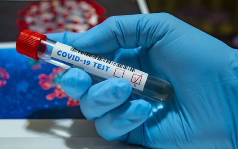 Tamponi diagnostici e di controllo