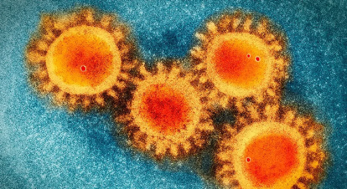 Coronavirus