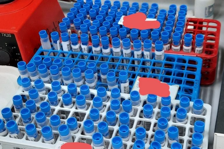 Coronavirus focolaio Rsa Cremona