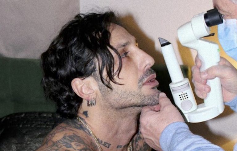 Fabrizio Corona cieco