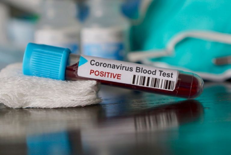 Nuovo paziente 1 coronavirus