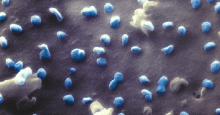 coronavirus attacca cellule renali