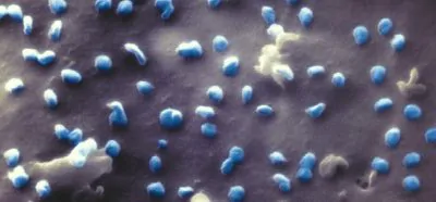 coronavirus attacca cellule renali