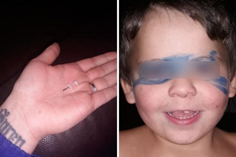 Ingoia puntina morto bambino