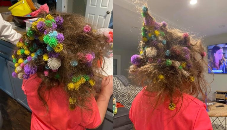 Palline nei capelli
